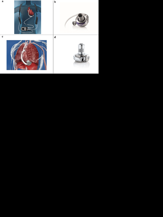 Schematic-presentation-of-the-HeartMate-3-a-and-HeartWare-LVAD-c-and-close-ups-of.png